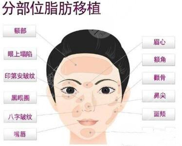 北京八大处脂肪面部填充反馈