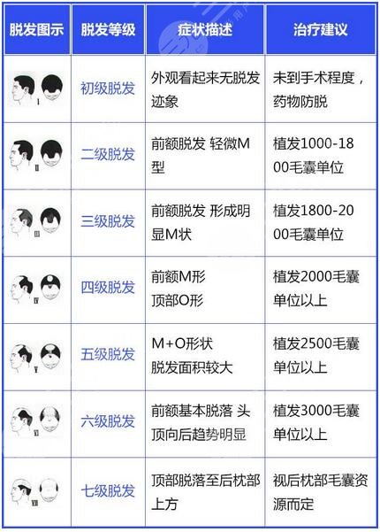 南方医科大学南方医院植发手术果图