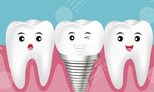 满口种植牙一般要多少钱？2023价格表一览+种牙过程+注意事项！
