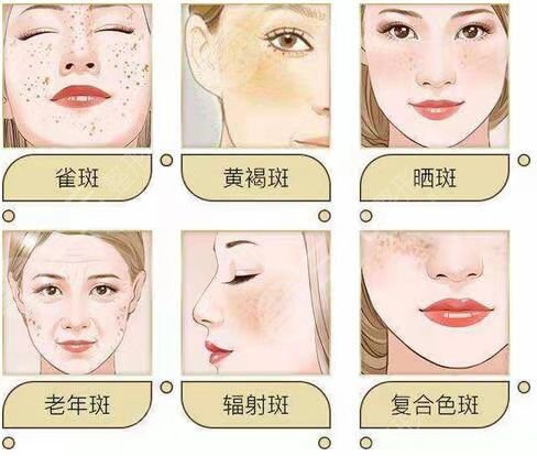 九院新一代热玛吉案例