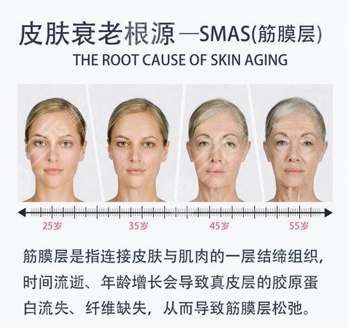 热玛吉除皱抗衰适合哪些人群?
