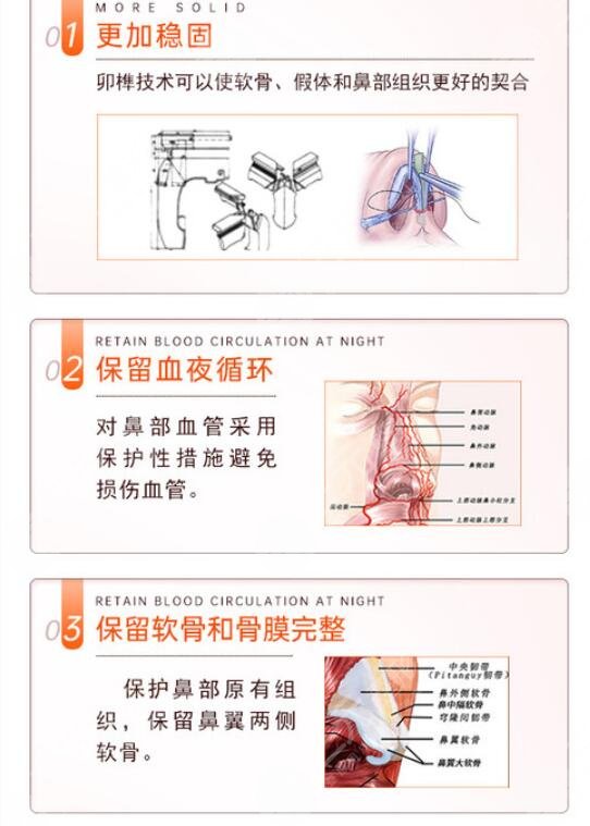 上海九院隆鼻整形科普