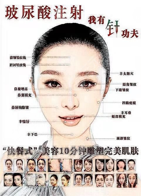 张大艳自体脂肪填充脸部手术术前