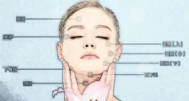 张大艳自体脂肪填充脸部手术术后30天