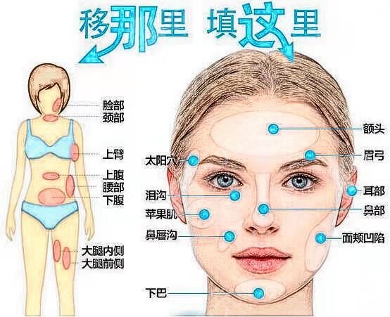 王阳脂肪填充前