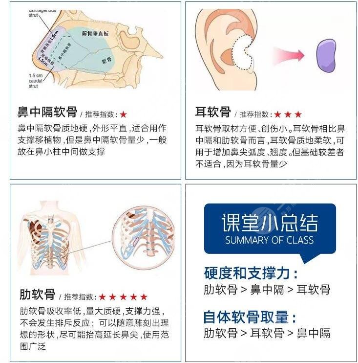 隆鼻优势