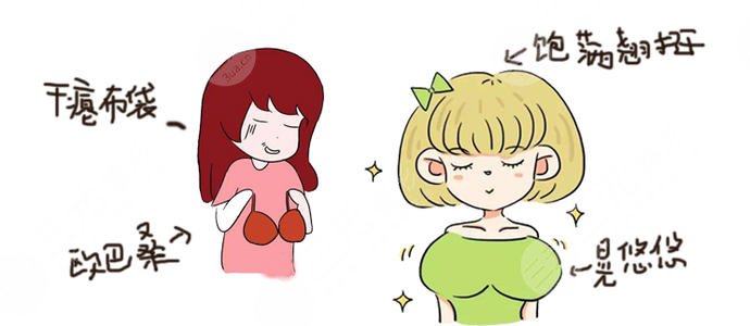 自体脂肪隆胸案例