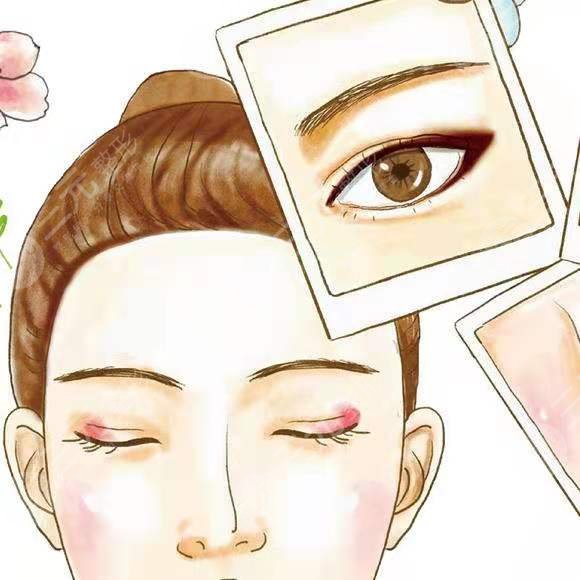 双眼皮修复手术后7天