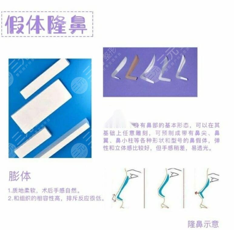 鼻部整形手术怎么做的