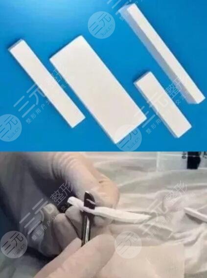 膨体隆鼻有哪些特点呢