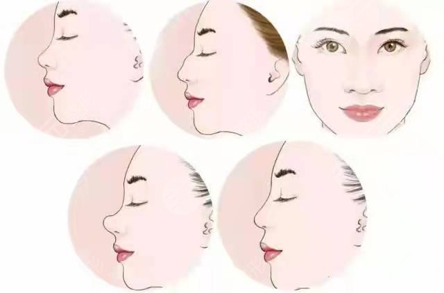 罗志敏做鼻子后