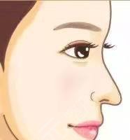 罗志敏做鼻子后住院