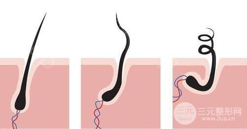 影响植发价格的因素有哪些?