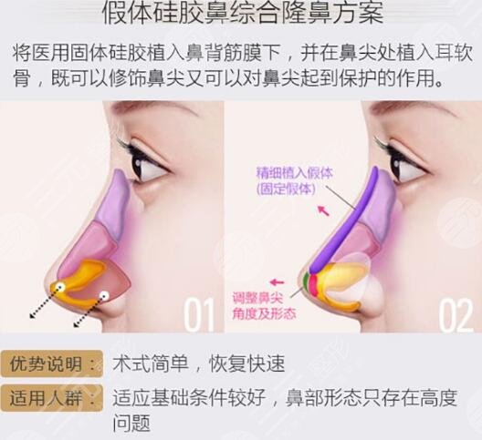 手术价格多少钱