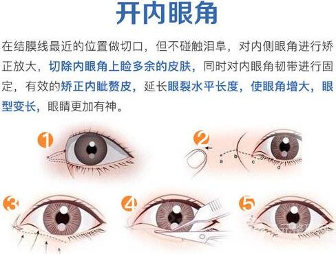 温州附二院整形美容科眼部整形怎么样
