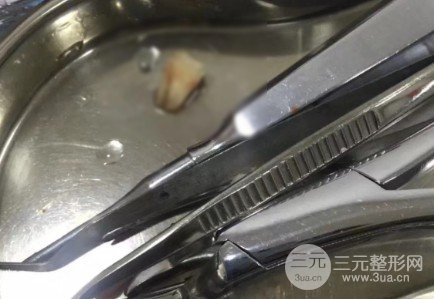 青岛口腔医院价目表