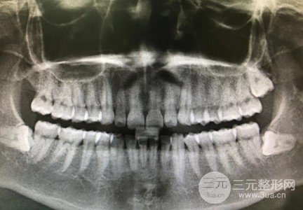 青岛口腔医院价目表