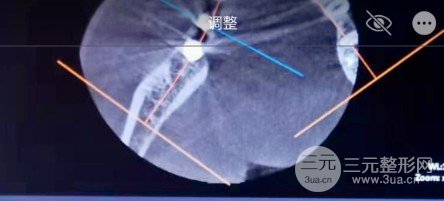 阳江华康口腔医院贵吗