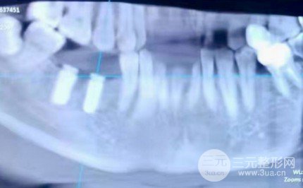 阳江华康口腔医院贵吗