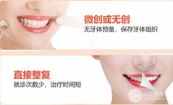 上海九院牙齿贴面技术好不好 价格