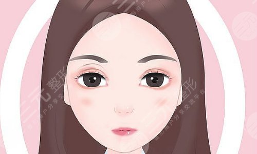 双眼皮修复整形手术
