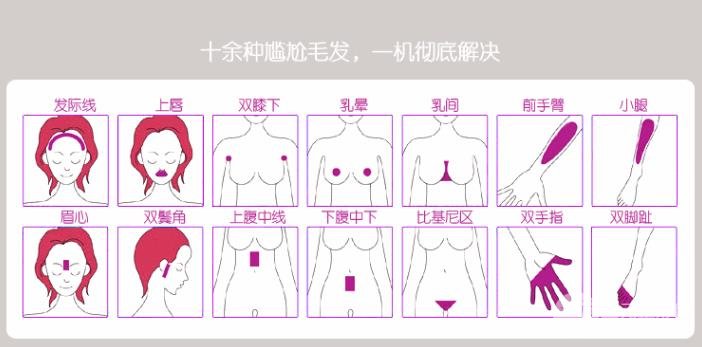 手术后注意事项