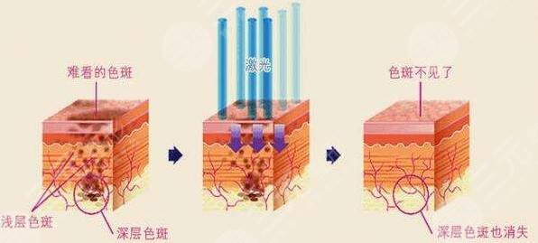 嘉兴第三医院美容科技术好不好