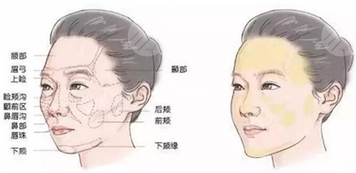 热玛吉治疗技术成熟吗