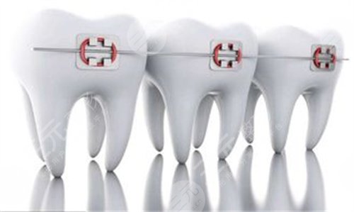 佛山向阳口腔牙齿矫正之前