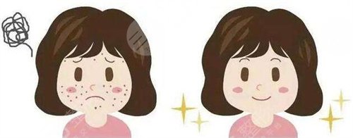 上海华山医院点痣流程图