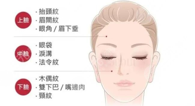 拉皮需要注意的问题