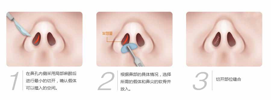 无锡丽都整形医院价格表详细完整曝光一览