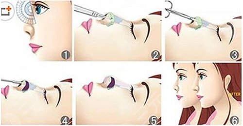 宁乡人民医院美容科整形技术