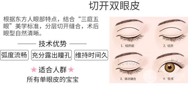 河南人民医院整形科割双眼皮技术怎么样
