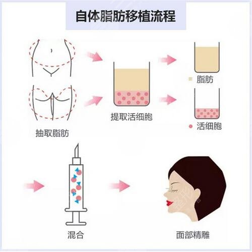 珠海中大五院美容科激光祛痘技术