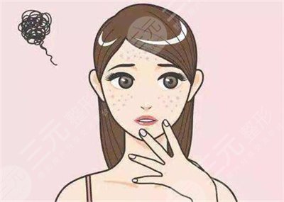 山东省立医院美容整形科治痘印价格表