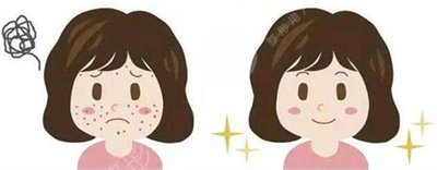 山东省立医院美容整形科治痘印价格表