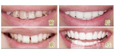 温岭牙博士收费怎么样
