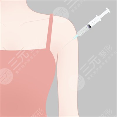 广州越秀丽尚医疗美容门诊部手臂吸脂术前