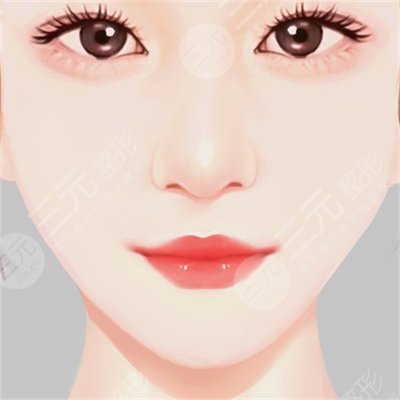 沈阳杏林美容院整形医院磨骨案例