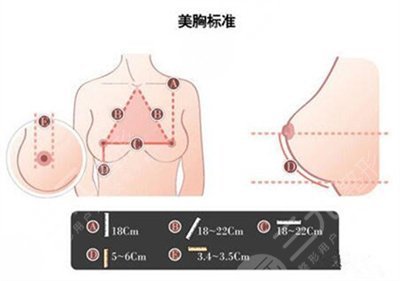 沈阳杏林美容院整形医院隆胸案例
