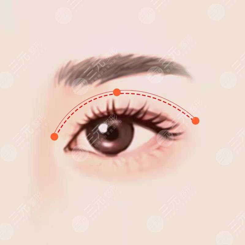 西京医院做双眼皮前