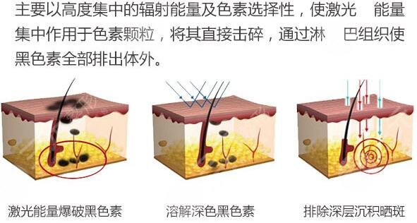 上海华山医院祛痣
