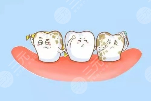 北京维尔口腔医院种植牙后