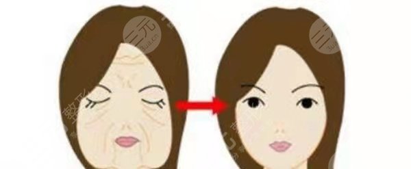 上海九院热玛吉术中