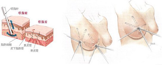 重庆东方整形医院