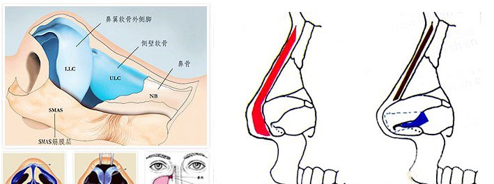 贵阳应超小李飞刀整形医院