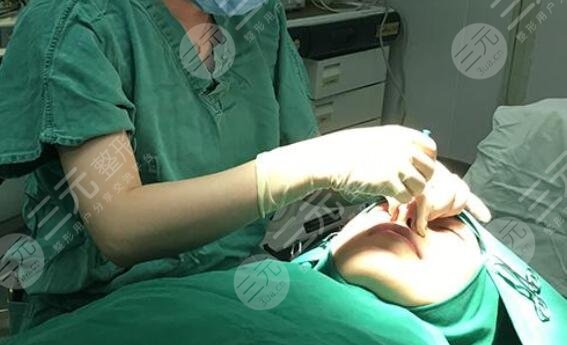 肋骨鼻手术经过