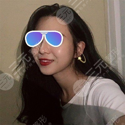 北大口腔补牙价格表