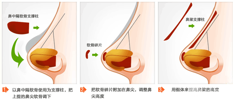 北京八大处整形科价目表